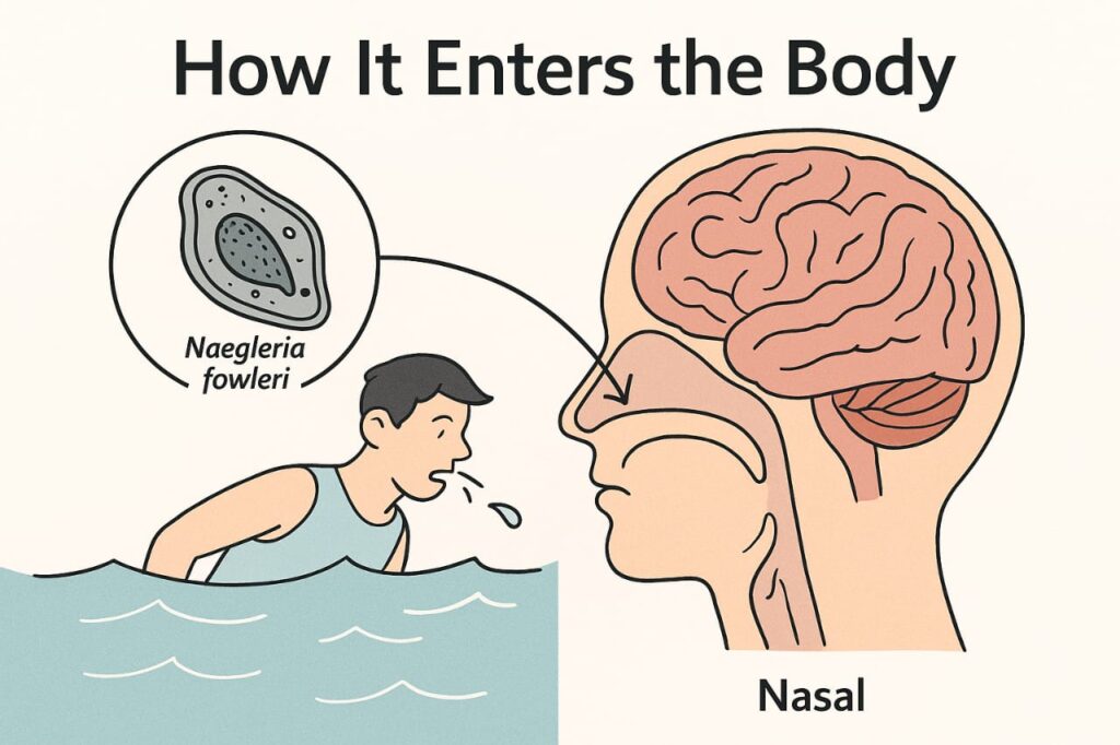 What Is a Brain-Eating Amoeba?